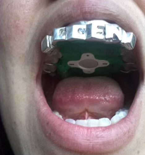 「箍牙」MP3 機  用舌頭調節音量