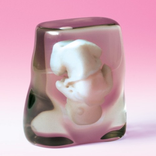 3D打印技術 超聲波影像激變怪異胎兒小擺件
