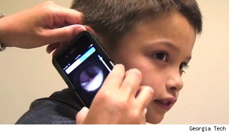 科研人員開發醫療用配件 讓iPhone變身耳鏡
