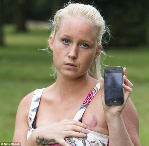 英國裸睡少女慘遭 iPhone 4 灼傷乳房
