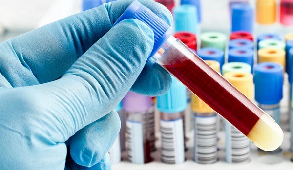 新型 miRNA 測試登場！只需一滴血即可驗到多達 13 種癌症