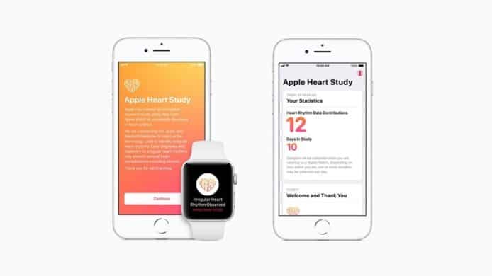 史丹福大學研究指 Apple Watch 偵測心律不整準確度超過八成