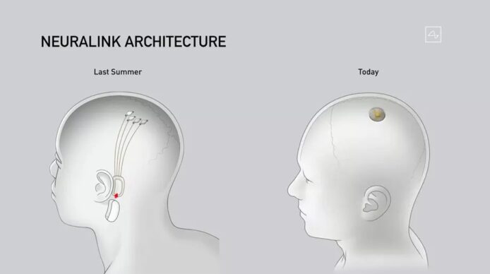 Neuralink 公佈腦機介面最新發展　成功植入豬隻腦袋