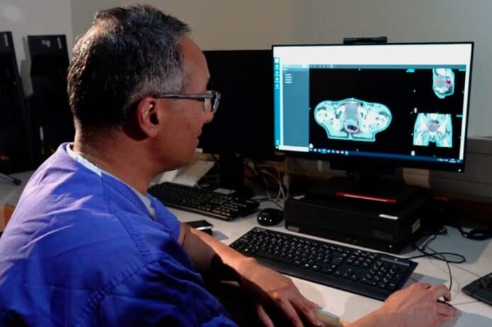 微軟 AI 縮短癌症放射治療時間   掃描速度提高 2.5 倍 + 準確率達 90%