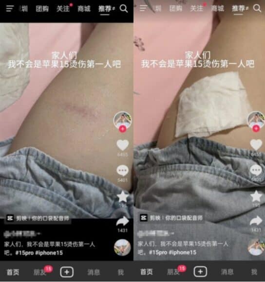iPhone 15 Pro 被中國用家批過熱　中國網民投訴被燙傷大腿 + 手指